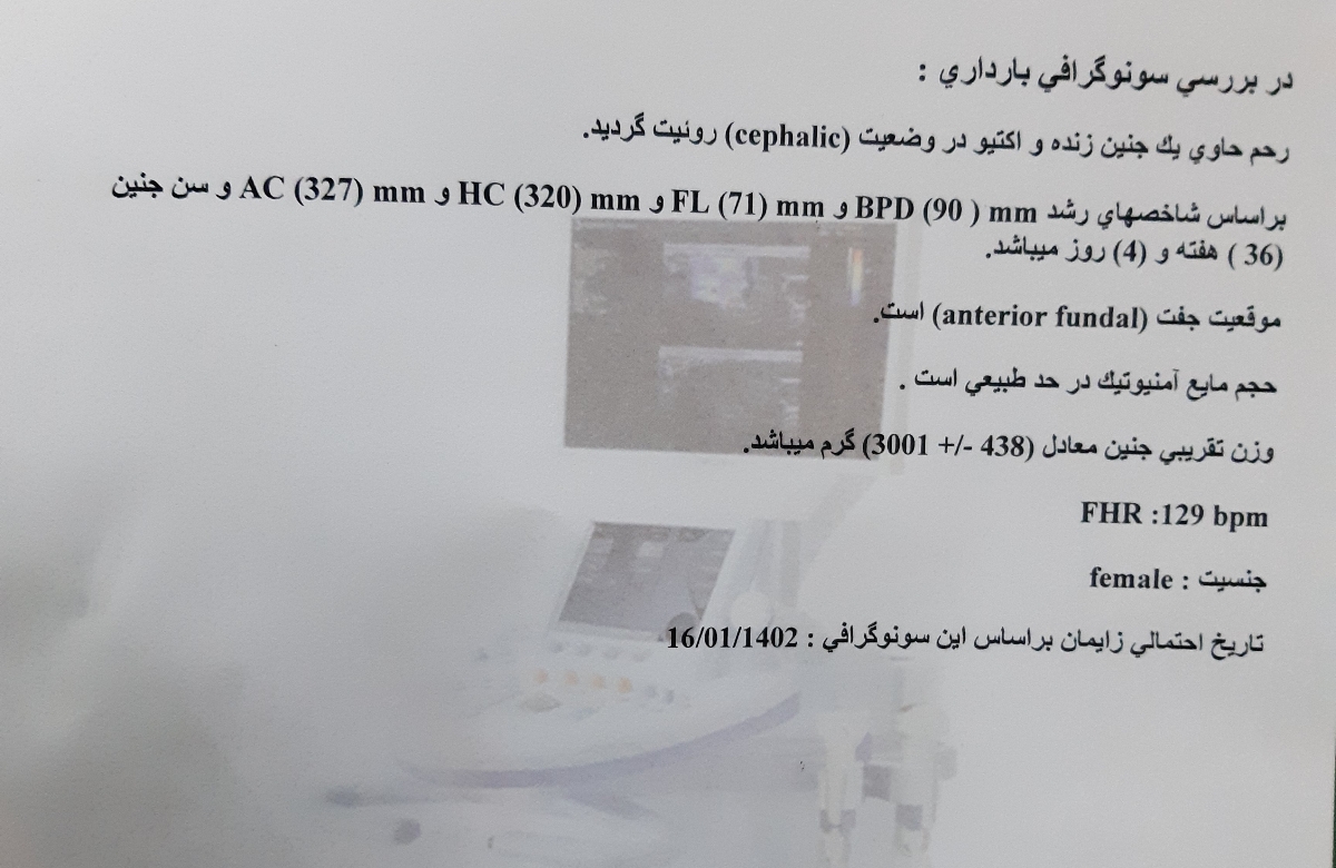 نفسیر سونو ۳۶ هفته نفسیر سونو ۳۶ هفته