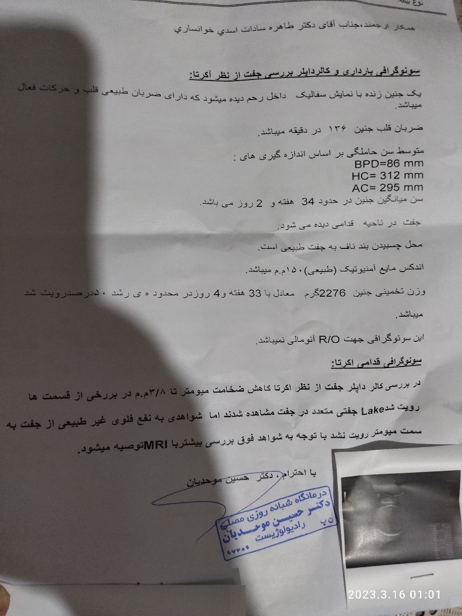 سلام دکتر امروز سونو وزن و جفت داشتم بی زحمت ی نگاه بهش میندازین؟ سلام دکتر امروز سونو وزن و جفت داشتم بی زحمت ی نگاه بهش میندازین؟