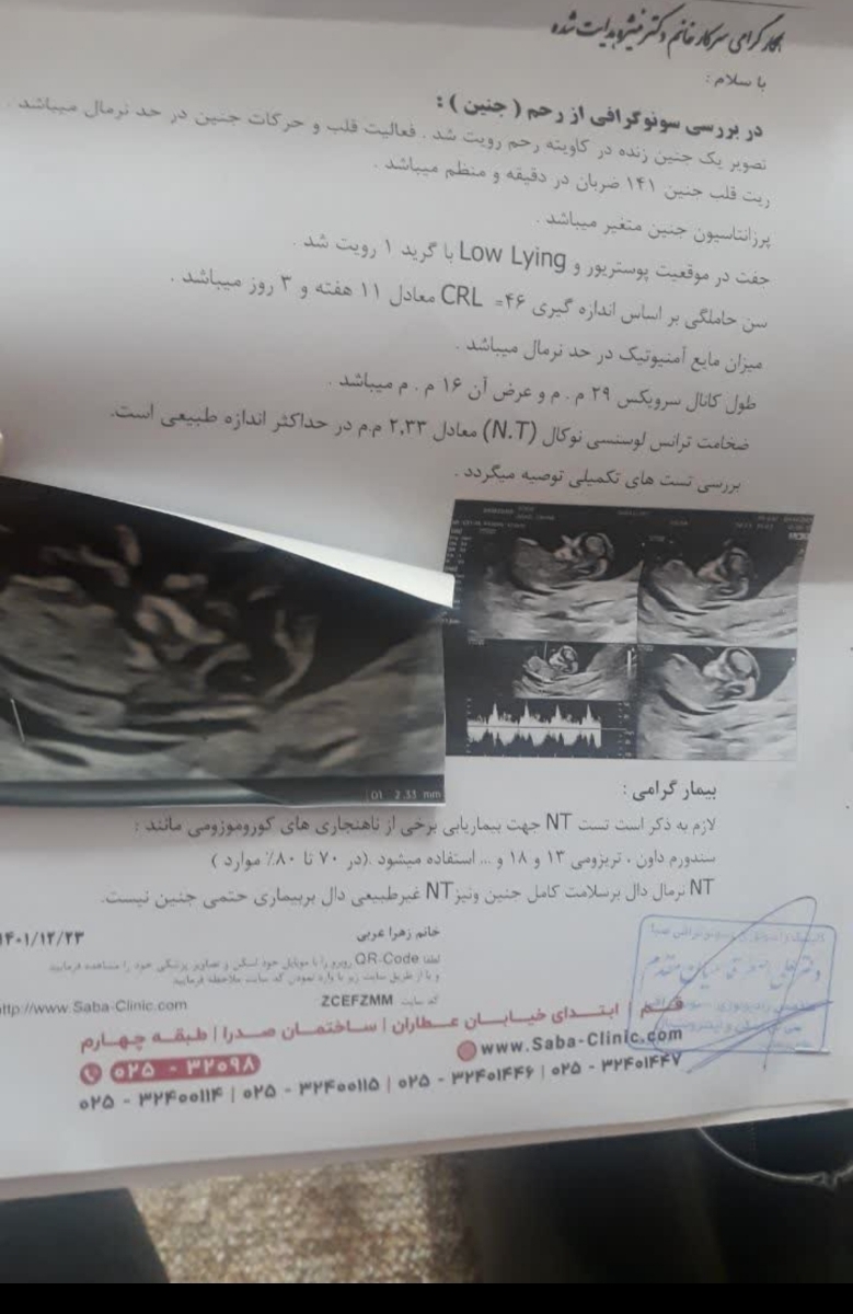 خانوما جواب ازمایش غربالگری اول توروخدا بیاین خانوما جواب ازمایش غربالگری اول توروخدا بیاین
