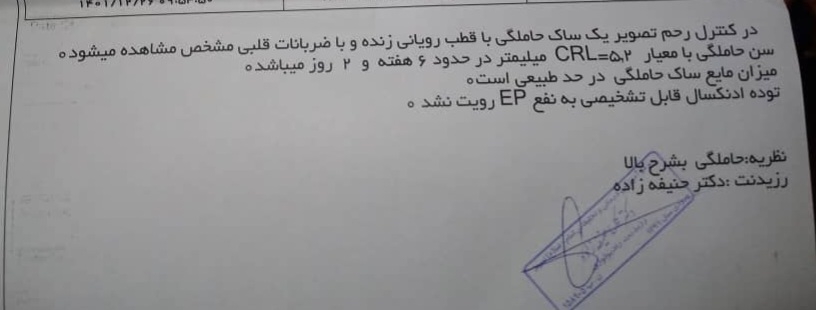 بررسی سونوی تشکیل قلب بررسی سونوی تشکیل قلب