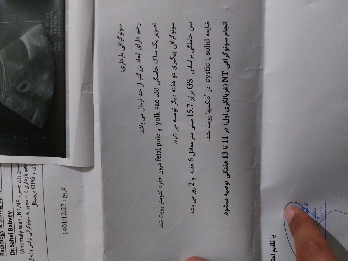 تشکیل شدن ساک بدون قلب تشکیل شدن ساک بدون قلب