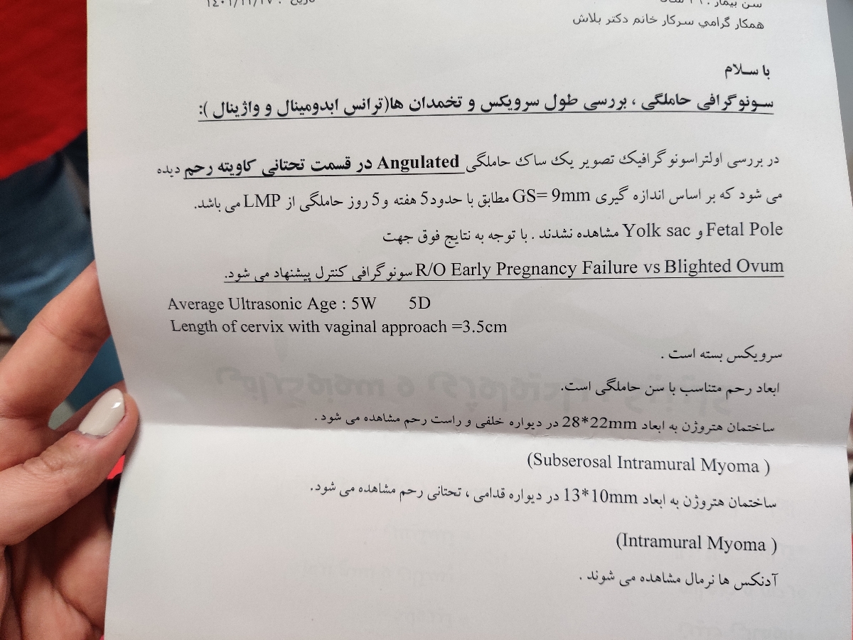 تشکیل شدن ساک بدون قلب تشکیل شدن ساک بدون قلب