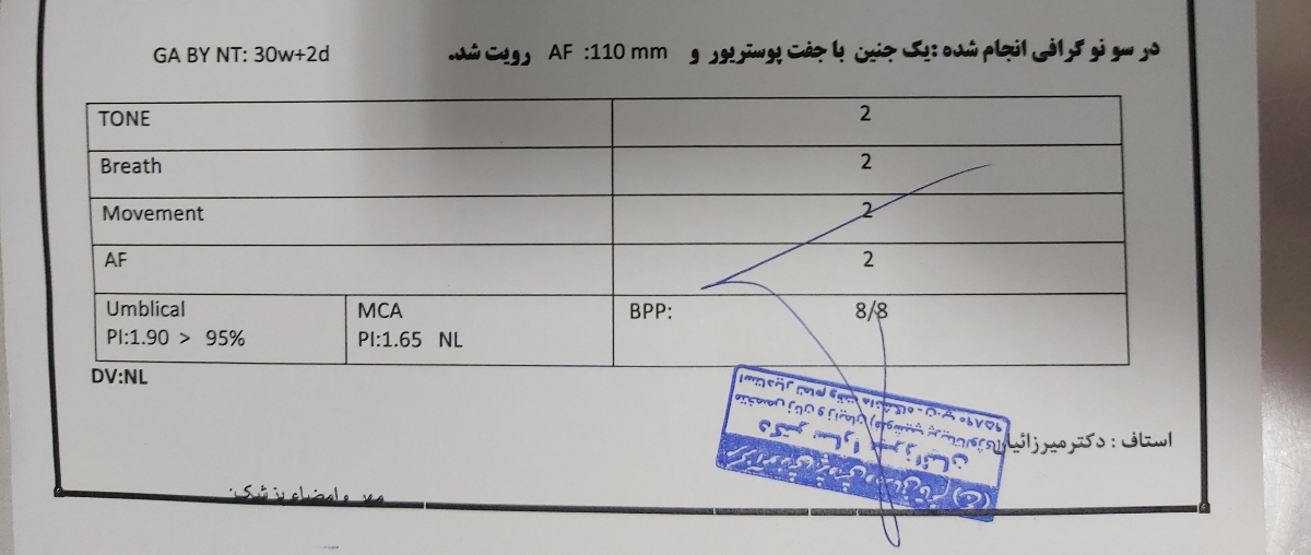 استفاده از قرص اسپرین خارجی بجای ایرانی امکانپذیر است؟ استفاده از قرص اسپرین خارجی بجای ایرانی امکانپذیر است؟