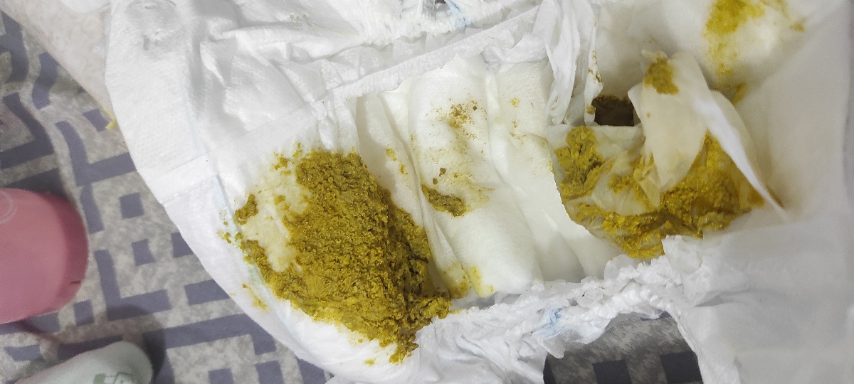 رنگ مدفوع طبیعیه یا نه، با ارزش پوزش سوالم همراهه عکسه رنگ مدفوع طبیعیه یا نه، با ارزش پوزش سوالم همراهه عکسه