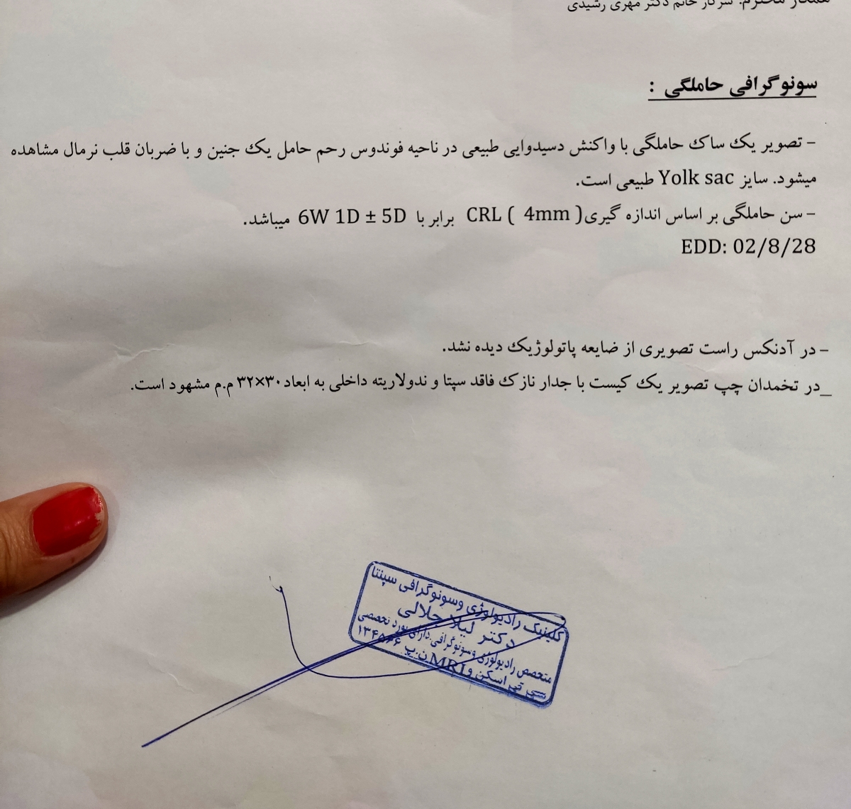 لکه بینی درهفته ی هفتم لکه بینی درهفته ی هفتم