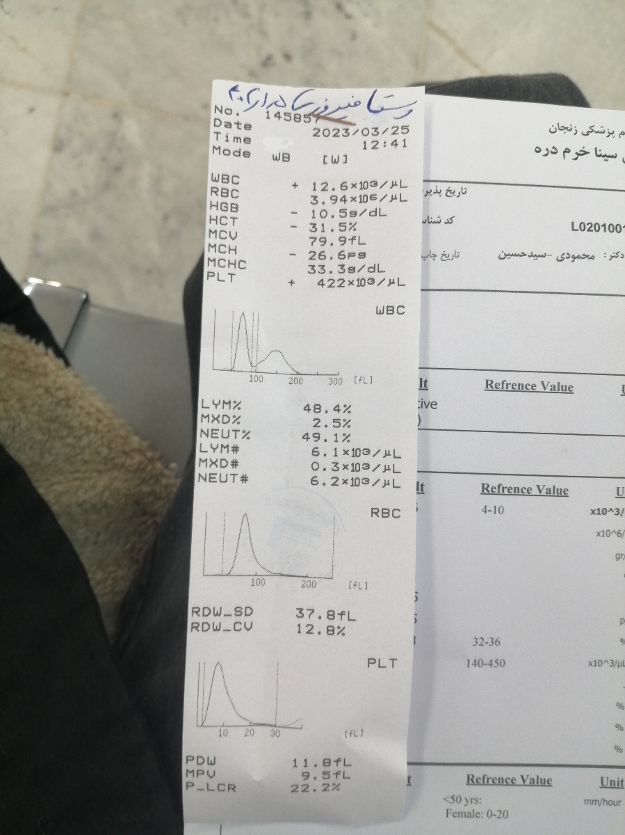 تب شیرخوار ده ماهه و علت ان