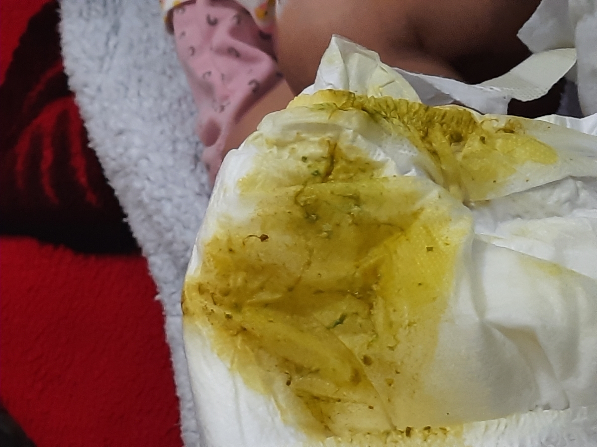 دفع نوزاد رنگ سبز دفع نوزاد رنگ سبز