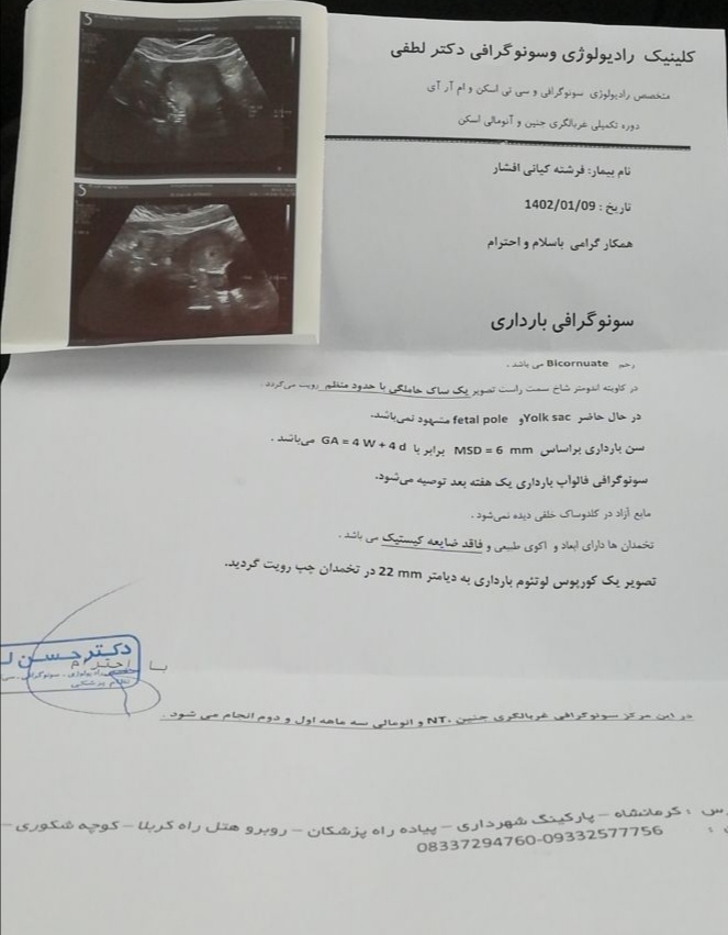 لکه بینی هفته هفنم