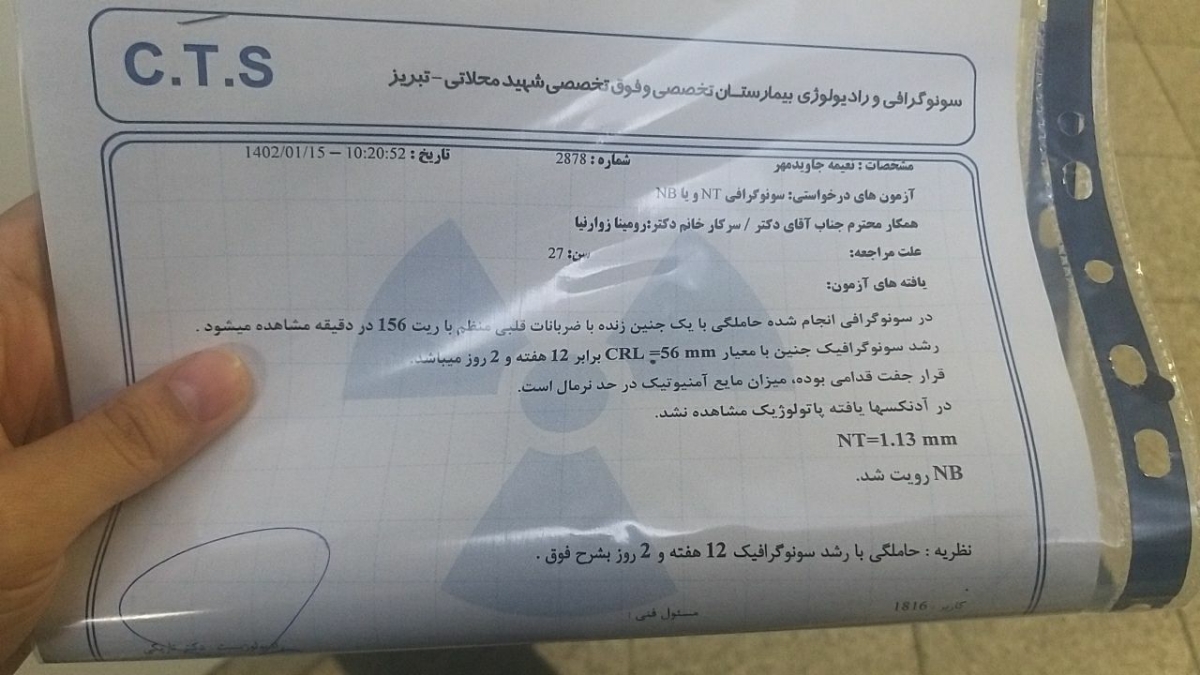 تفسیر ان تی در ۱۲هفته