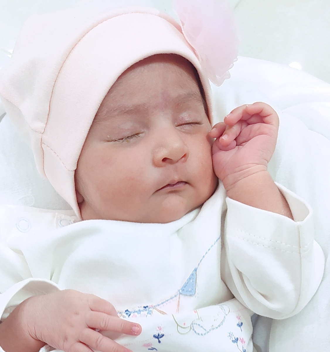 چرک کردن چشم نوزاد چرک کردن چشم نوزاد
