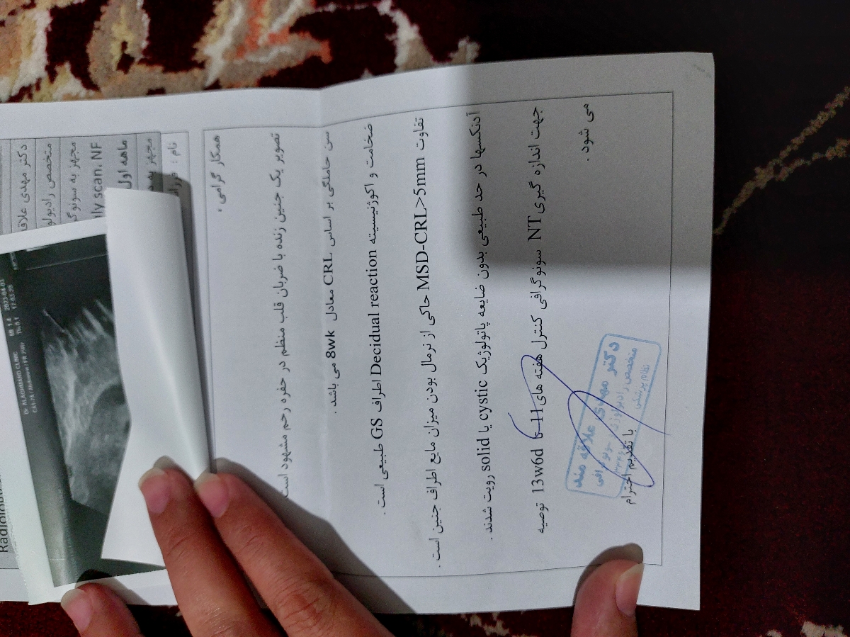 تشکیل شدن ساک بدون قلب تشکیل شدن ساک بدون قلب