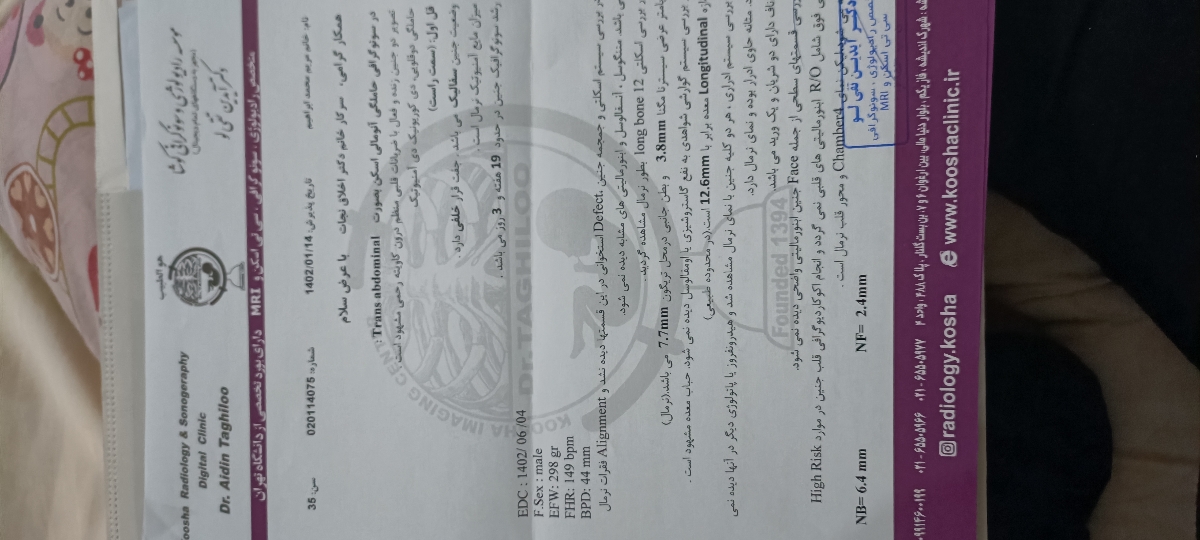 وزن دوقلویی در سونو وزن دوقلویی در سونو