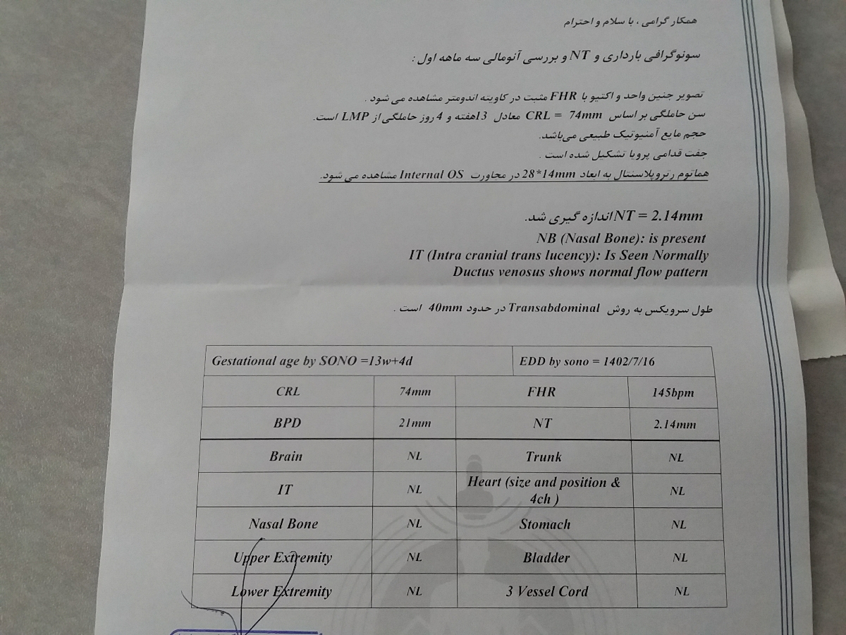 تفسیر سونو ان تی 😁😁 تفسیر سونو ان تی 😁😁