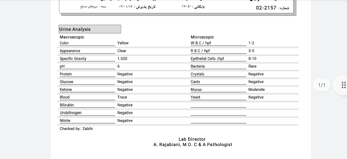 سوزش ادرار درد پهلو