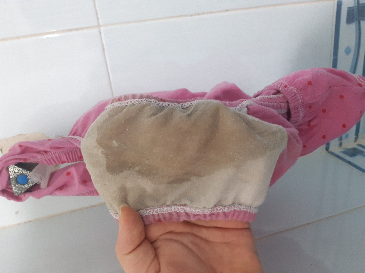 دهانه رحمم ۳ سانتی متر باز شده دهانه رحمم ۳ سانتی متر باز شده