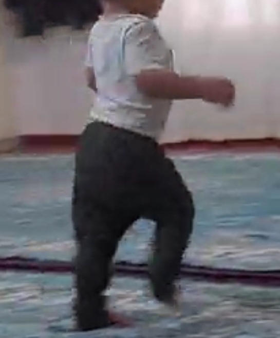 کیپ شدن بینی تو خواب