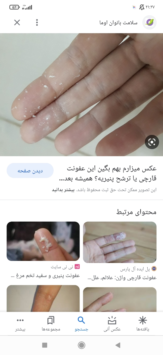 ترشح سفید دربارداری خطرناکه؟ ترشح سفید دربارداری خطرناکه؟