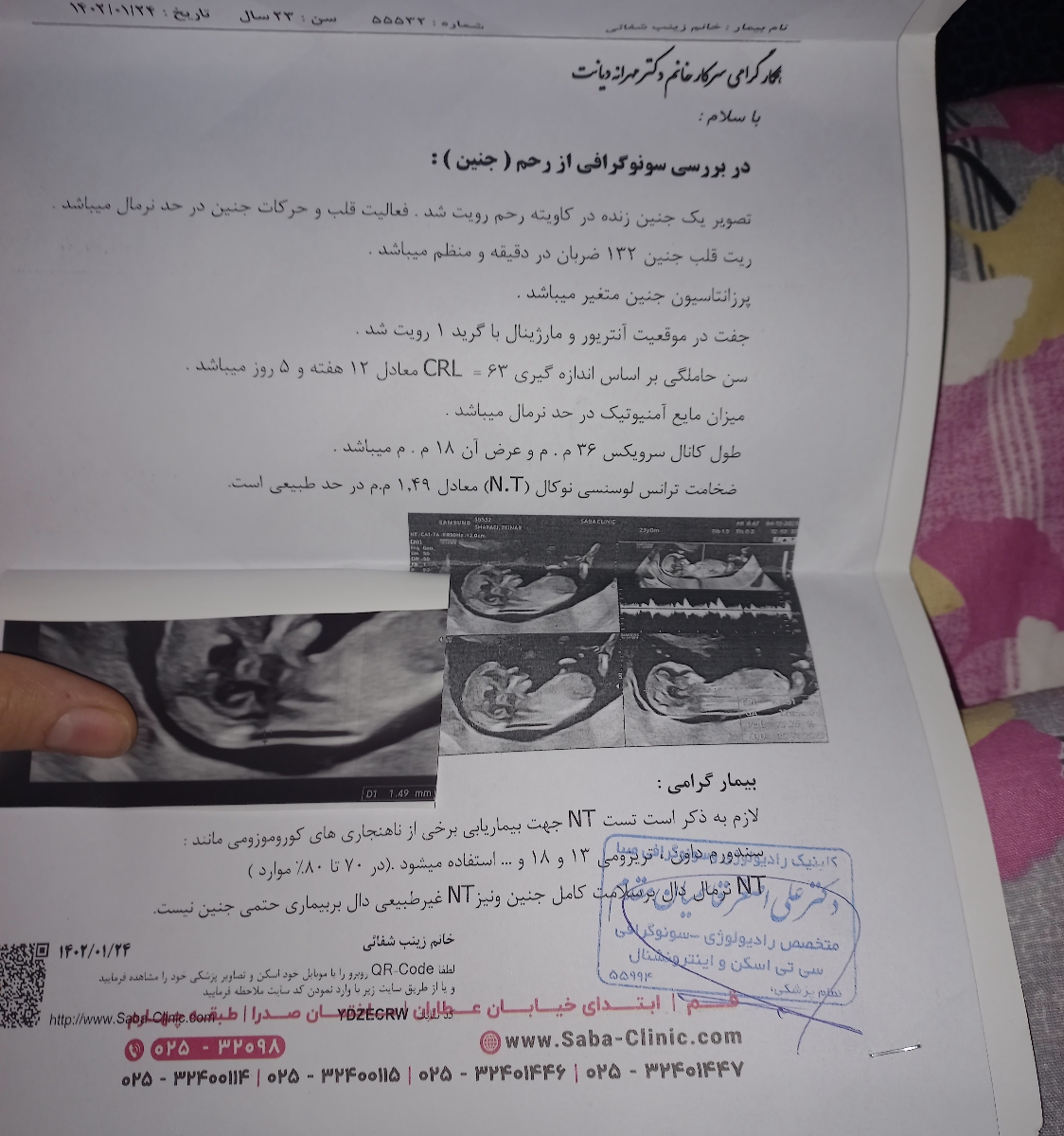 سونوگرافی ان تی ۱۲ هفته و ۵ روز سونوگرافی ان تی ۱۲ هفته و ۵ روز