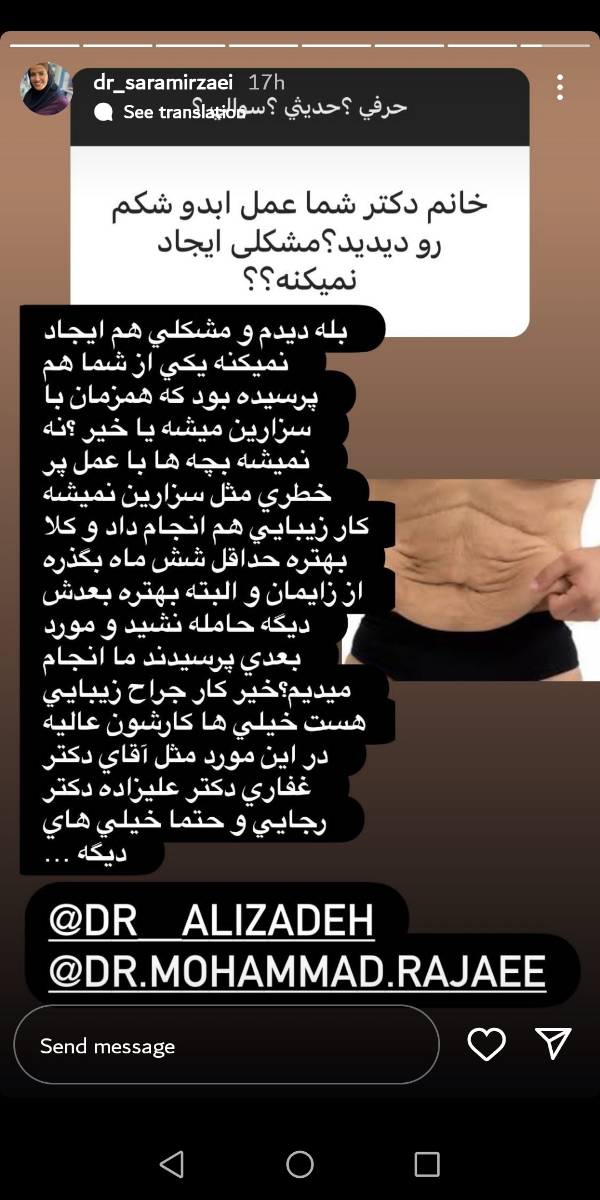 عمل برداشتن چربی شکم همراه باسزارین امکان پذیراست؟