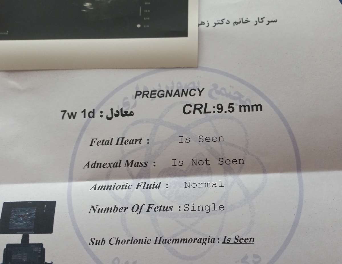 سونوگرافی در هفته ۷ و لکه بینی سونوگرافی در هفته ۷ و لکه بینی
