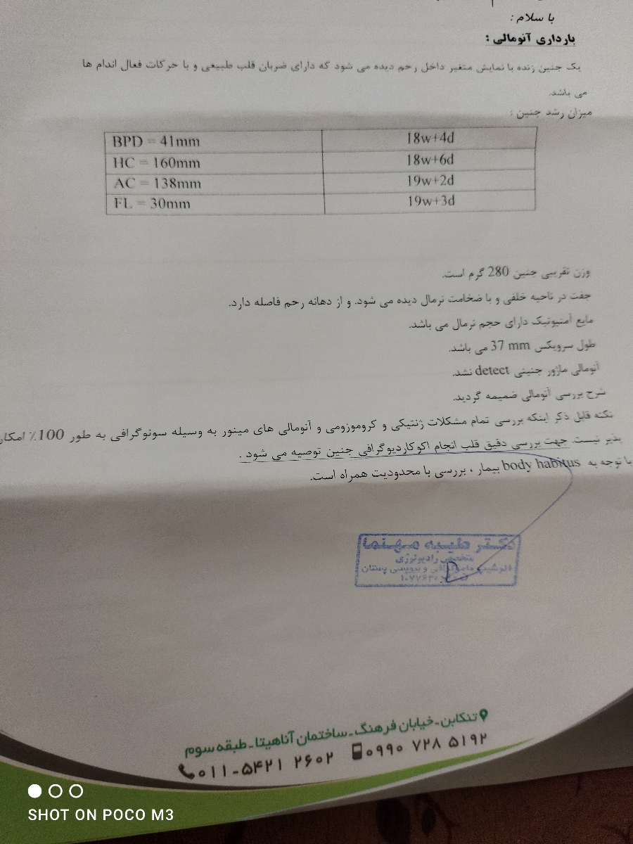 جواب آنومالی من چطوره ؟