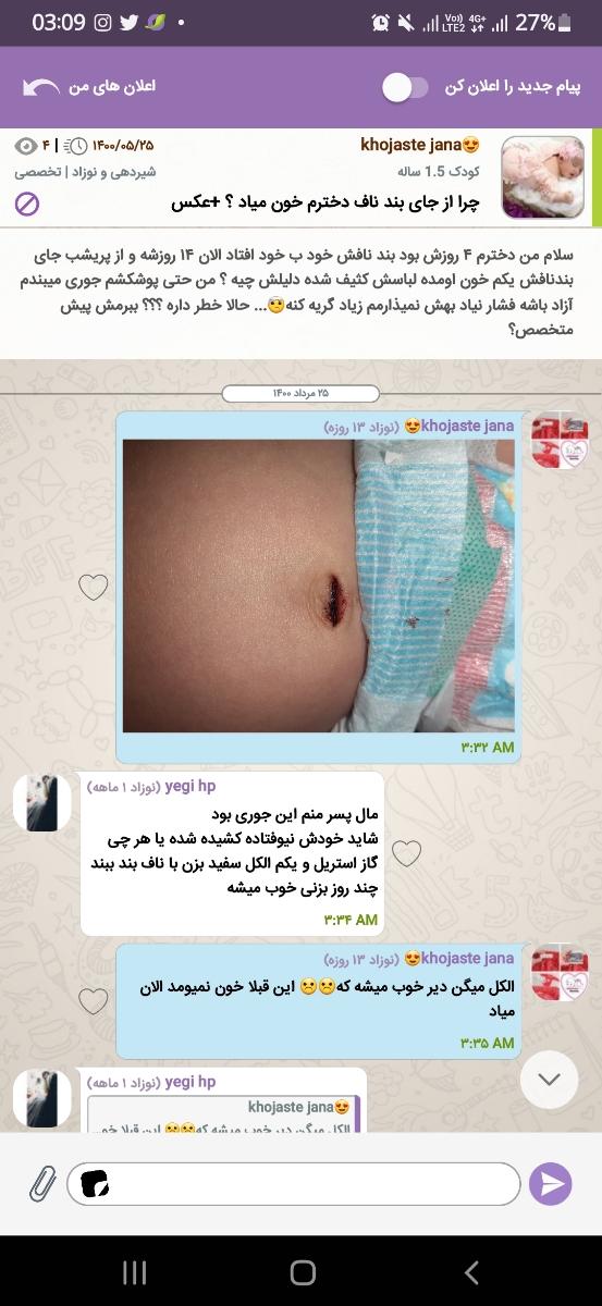 عکس از ناف نوزاد عکس از ناف نوزاد