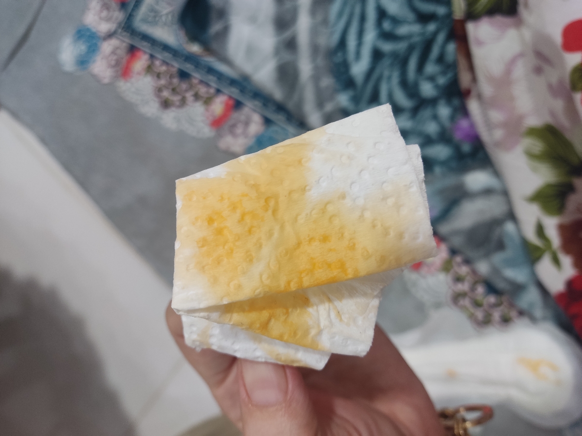 ترشح نارنجی طبیعیه یا بخاطر شیافه؟(همراه باعکس) ترشح نارنجی طبیعیه یا بخاطر شیافه؟(همراه باعکس)