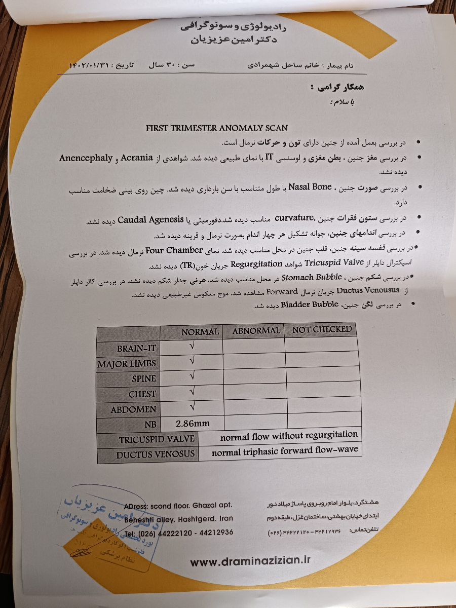 تفسیر سونوی ان تی تفسیر سونوی ان تی