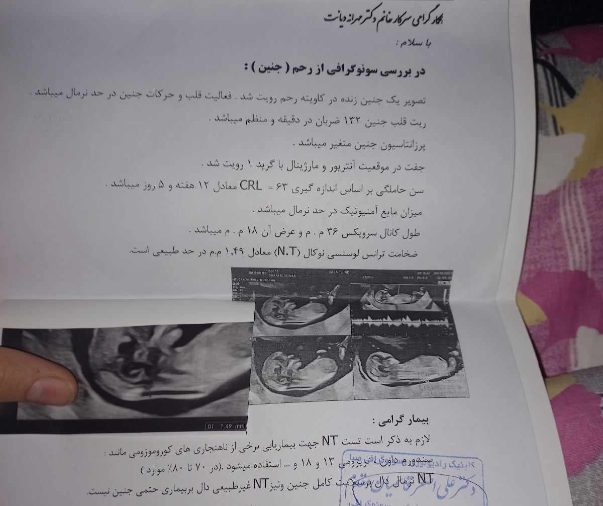جواب آزمایش غربالگری مرحله اول