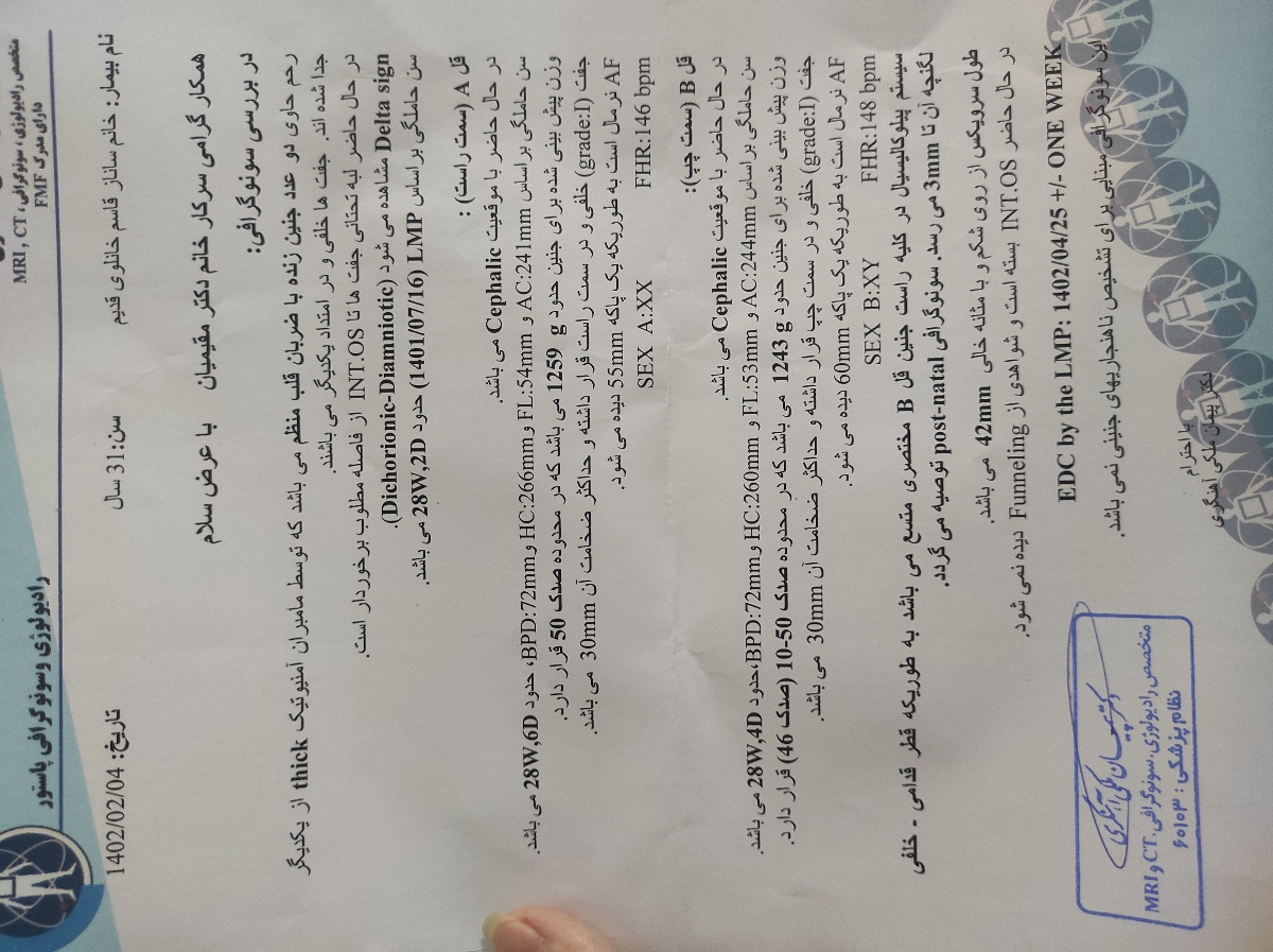 سونوی وزن و کیسه آب دوقلویی ۲۸ هفته