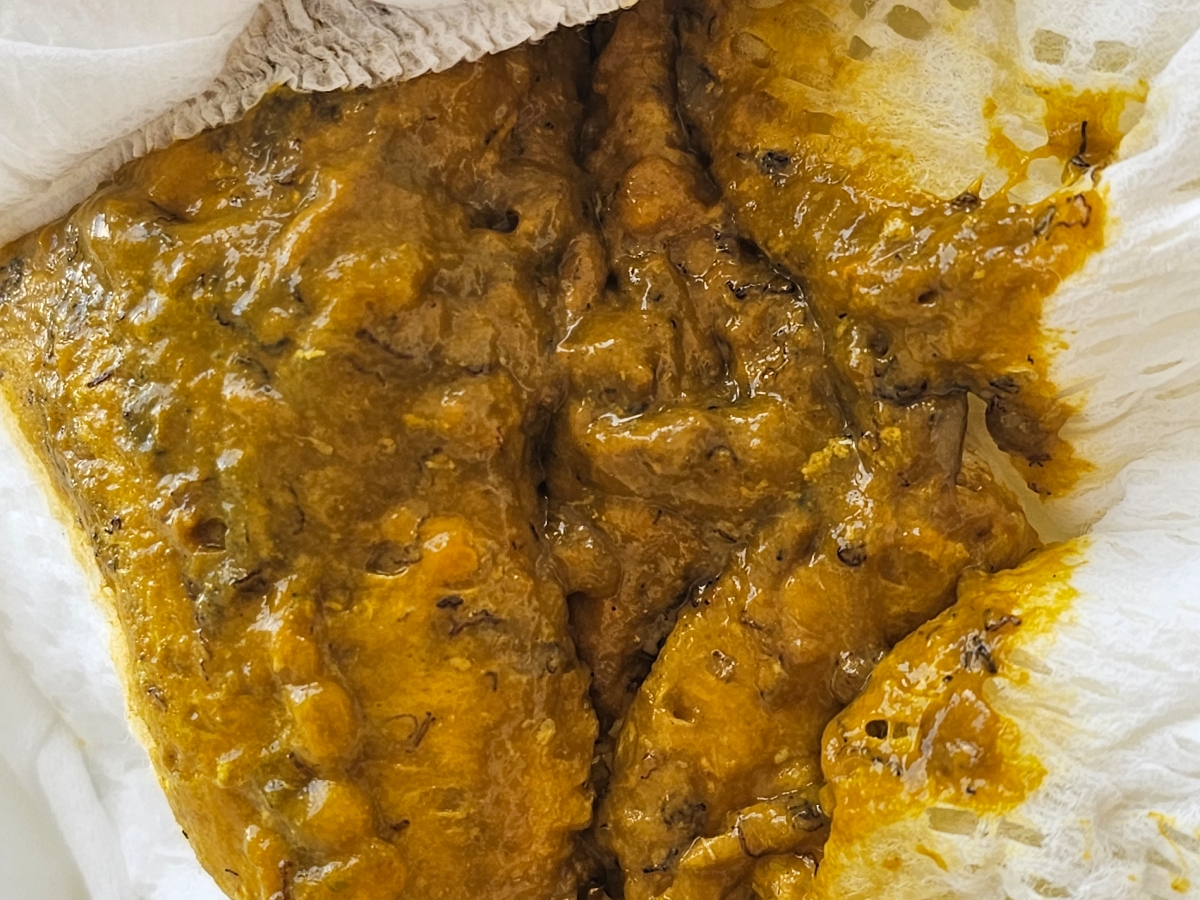 مدفوع عجیب نوزاد ۷ ماهه مدفوع عجیب نوزاد ۷ ماهه