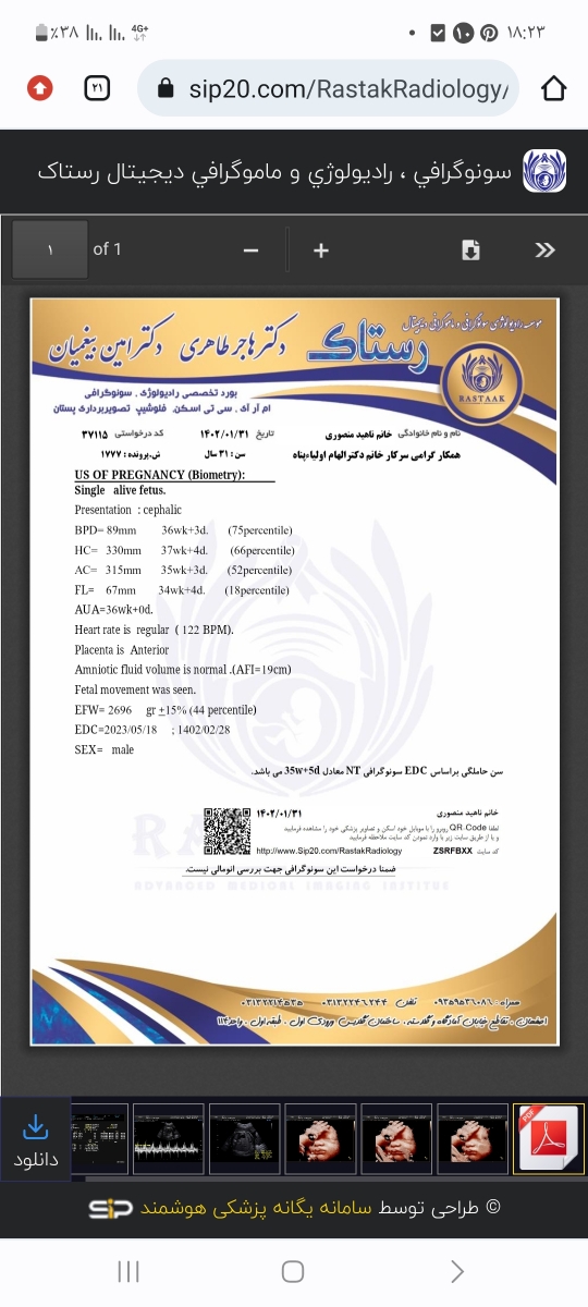 مایع دور جنین و آزمایش قند دوساعته