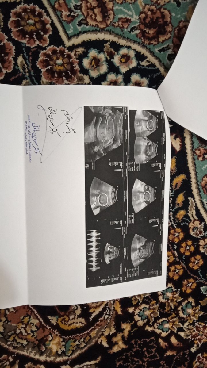 کسی درمورد سرویکس میدونه کسی درمورد سرویکس میدونه