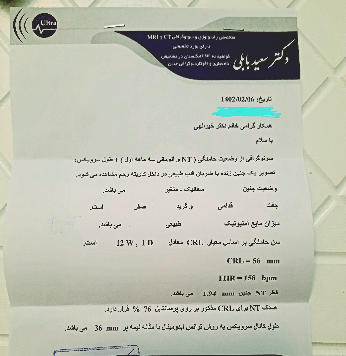 طول سرویکس در هفته ۱۳ طول سرویکس در هفته ۱۳