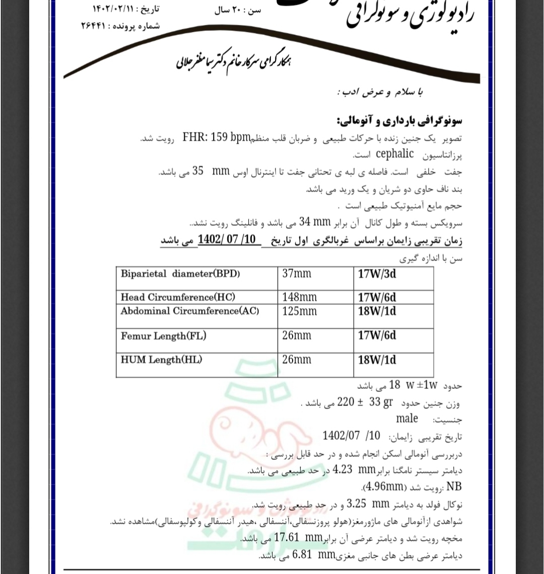 کیست کروئید پلکسوس در مغز جنین کیست کروئید پلکسوس در مغز جنین