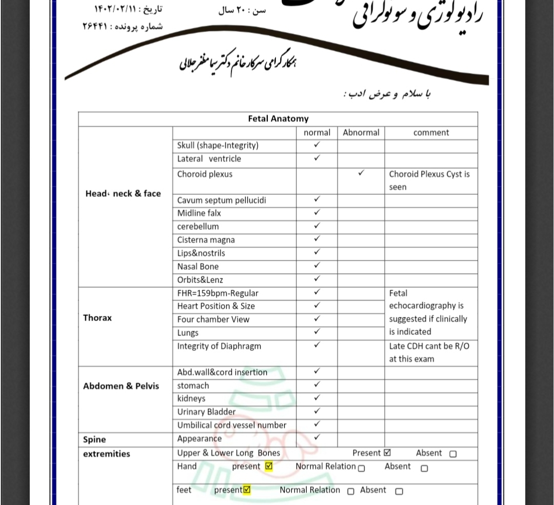کیست کروئید پلکسوس در مغز جنین کیست کروئید پلکسوس در مغز جنین