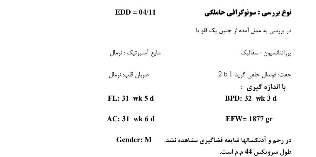 تفسیر سونوگرافی وزن جنین