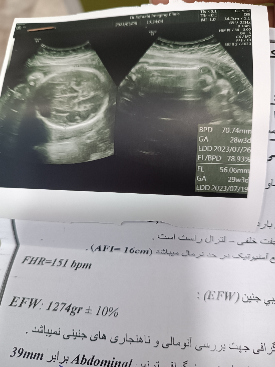 بررسی سونو وزن و آب جنین بررسی سونو وزن و آب جنین