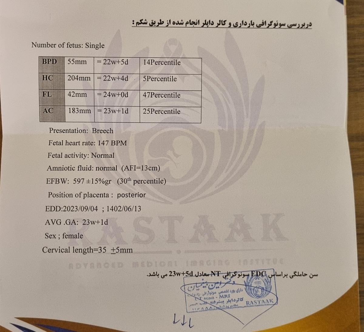 نظرتون راجع به سونو داپلر نظرتون راجع به سونو داپلر