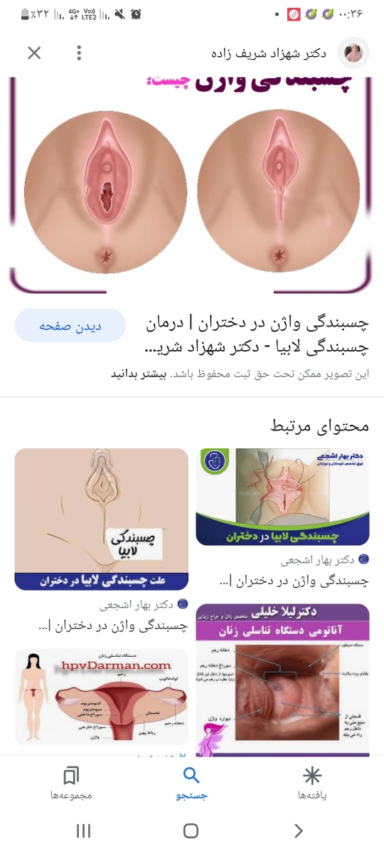 تورم و باد کردن واژن در بارداری تورم و باد کردن واژن در بارداری