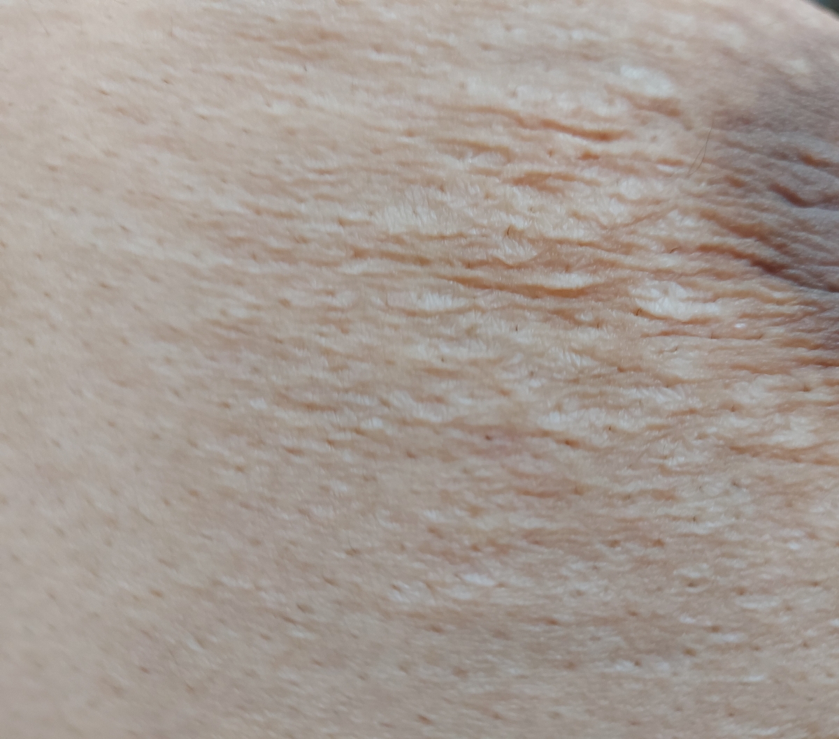 آیا چروک شدن سینه بخاطر شیردهیه آیا چروک شدن سینه بخاطر شیردهیه