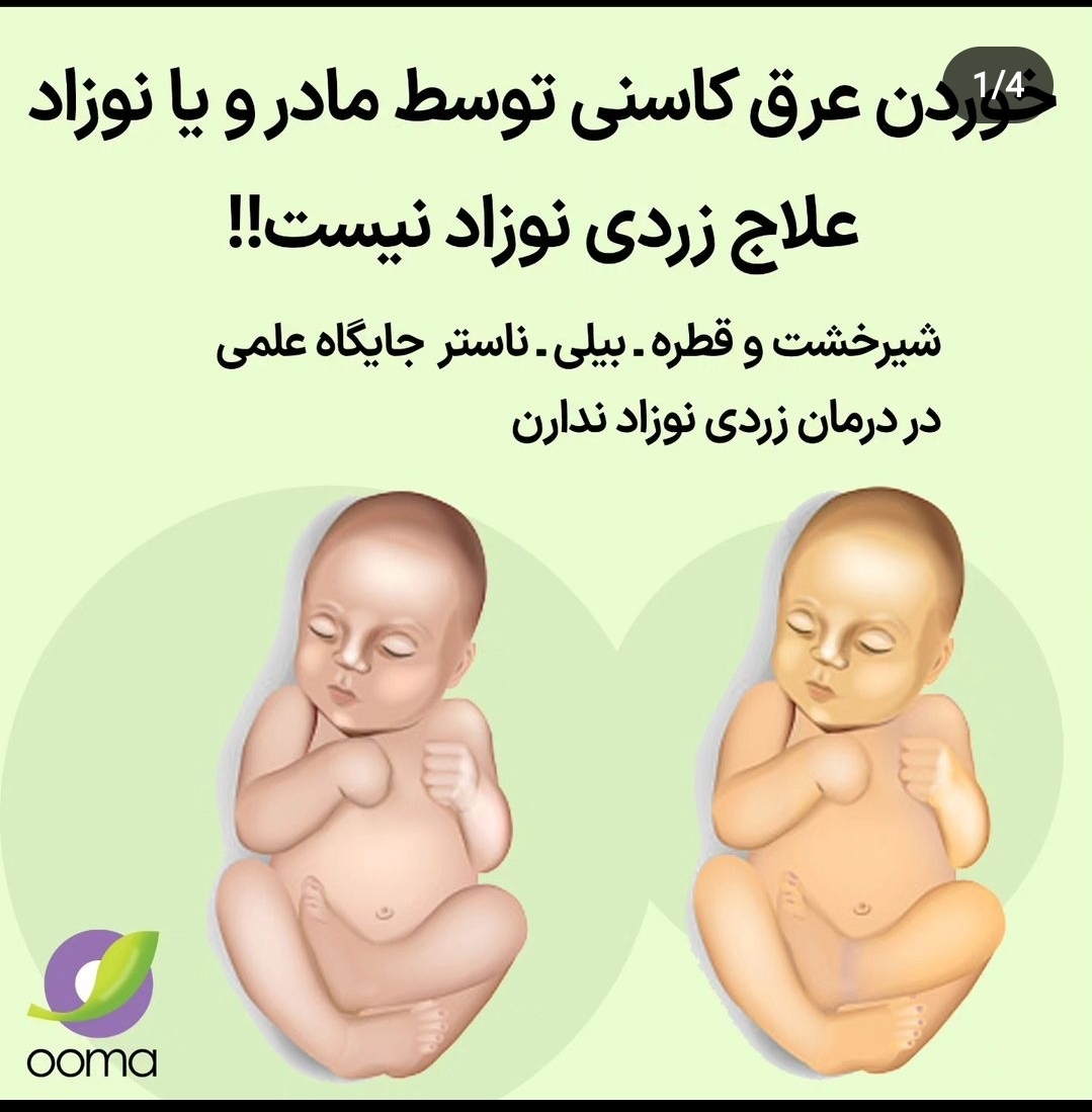 زردی نوزاد چهار روزه زردی نوزاد چهار روزه