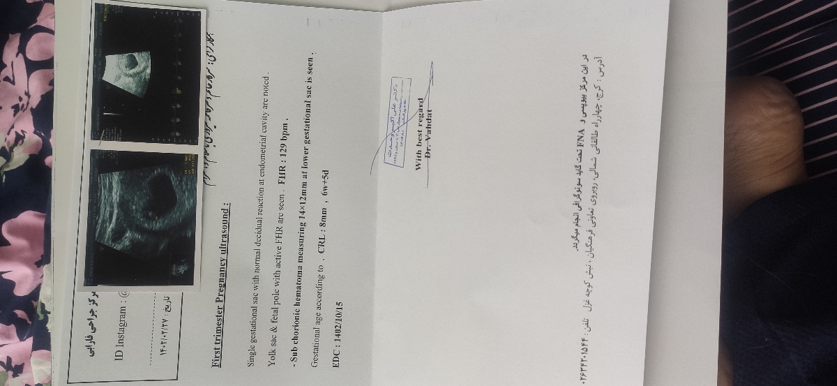 اولین سونوگرافی بارداری، هفته هفتم اولین سونوگرافی بارداری، هفته هفتم