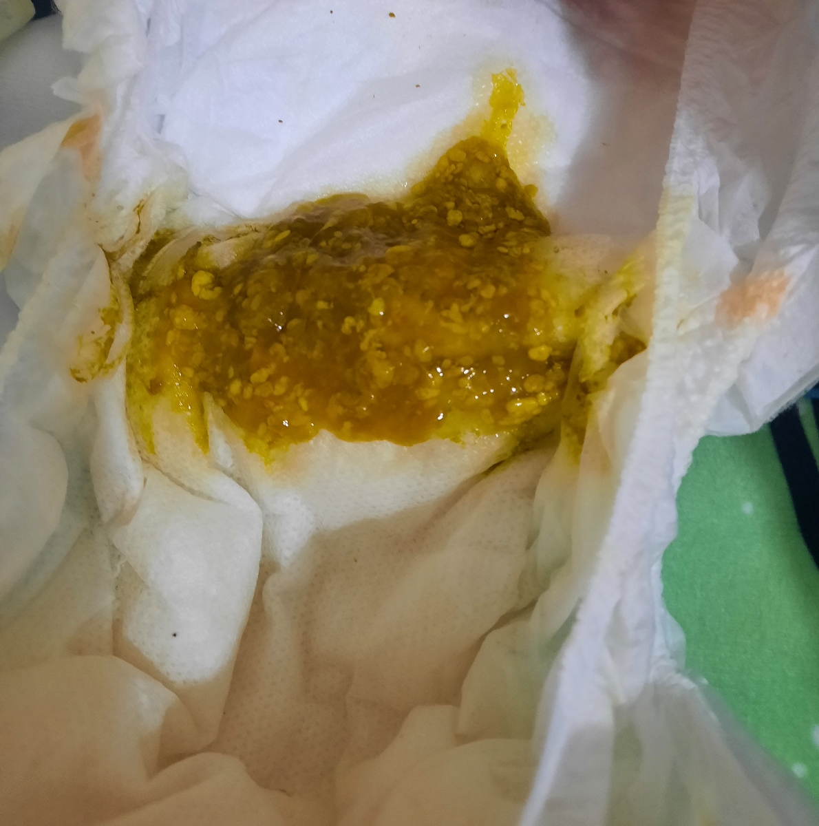 مدفوع پسر ۳۹ روزه (عکس)