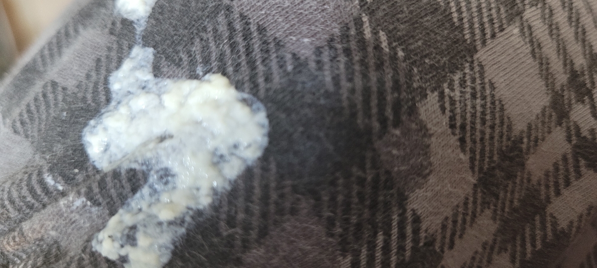 ناف نوزاد ۴۳ روزه