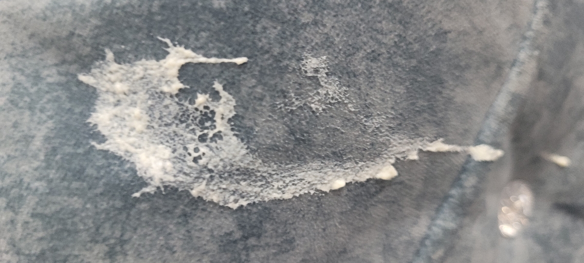 ناف نوزاد ۴۳ روزه