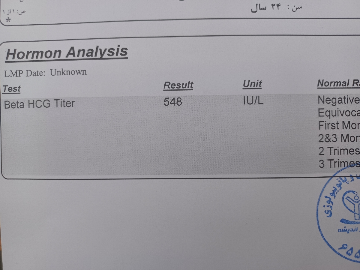 آزمایش بعد ۴ روز تاخیر آزمایش بعد ۴ روز تاخیر
