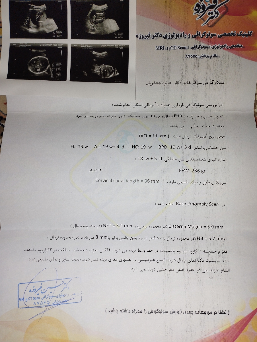 مکمل در دوران بارداری مکمل در دوران بارداری