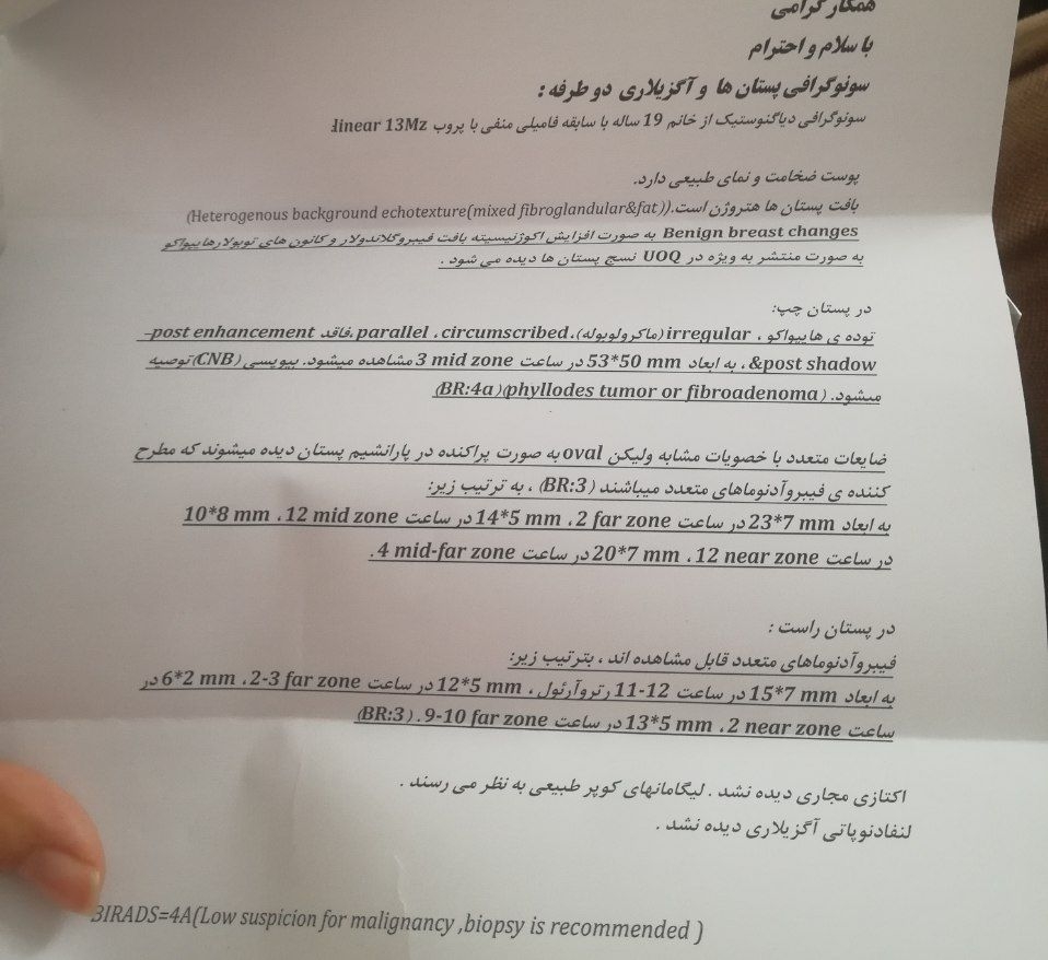 تفسیر سونوگرافی سینه فیبروآدنوم تفسیر سونوگرافی سینه فیبروآدنوم