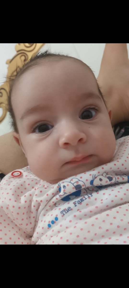 کوچیک شدن چشم نوزاد
